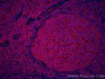 IL-28A Antibody in Immunohistochemistry (Paraffin) (IHC (P))