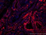 Thyroglobulin Antibody in Immunohistochemistry (Paraffin) (IHC (P))