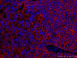 E-cadherin Antibody in Immunohistochemistry (Paraffin) (IHC (P))