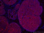 E-cadherin Antibody in Immunohistochemistry (Paraffin) (IHC (P))