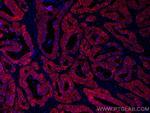 Cadherin-17 Antibody in Immunohistochemistry (Paraffin) (IHC (P))