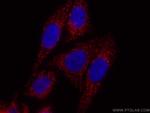 ATP5A1 Antibody in Immunocytochemistry (ICC/IF)