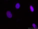 RBM15 Antibody in Immunocytochemistry (ICC/IF)