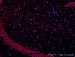 MAOB Antibody in Immunohistochemistry (Paraffin) (IHC (P))