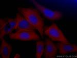 Aldolase C Antibody in Immunocytochemistry (ICC/IF)