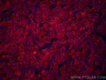 Transferrin Antibody in Immunohistochemistry (Paraffin) (IHC (P))