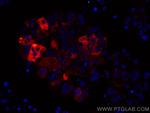 Mammaglobin A Antibody in Immunohistochemistry (Paraffin) (IHC (P))