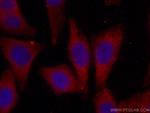 D2HGDH Antibody in Immunocytochemistry (ICC/IF)