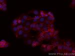 Beta Catenin Antibody in Immunocytochemistry (ICC/IF)