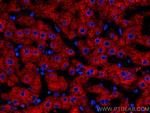 Plasminogen Antibody in Immunohistochemistry (Paraffin) (IHC (P))