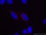 GABARAPL1 Antibody in Immunocytochemistry (ICC/IF)