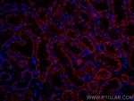 PCCB Antibody in Immunohistochemistry (Paraffin) (IHC (P))