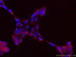 AP5Z1/SPG48 Antibody in Immunocytochemistry (ICC/IF)