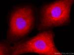 HE4 Antibody in Immunocytochemistry (ICC/IF)