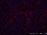Cytokeratin 13 Antibody in Immunohistochemistry (Paraffin) (IHC (P))