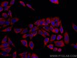 GSTP1 Antibody in Immunocytochemistry (ICC/IF)