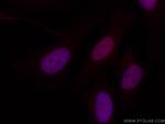 RBX1 Antibody in Immunocytochemistry (ICC/IF)