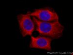 HSP27 Antibody in Immunocytochemistry (ICC/IF)