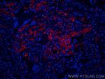 Glycophorin A Antibody in Immunohistochemistry (Paraffin) (IHC (P))