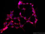 CDR2L Antibody in Immunocytochemistry (ICC/IF)