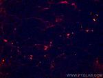 Collagen Type VI Antibody in Immunohistochemistry (Paraffin) (IHC (P))
