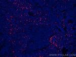 S100A8 Antibody in Immunohistochemistry (Paraffin) (IHC (P))