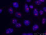 DDX21 Antibody in Immunocytochemistry (ICC/IF)