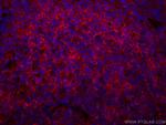 CD40 Antibody in Immunohistochemistry (Paraffin) (IHC (P))