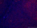 CD40 Antibody in Immunohistochemistry (Paraffin) (IHC (P))