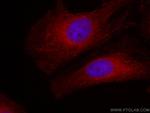 FLII Antibody in Immunocytochemistry (ICC/IF)
