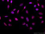 PI3 Kinase p110 Beta Antibody in Immunocytochemistry (ICC/IF)