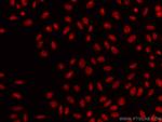 SSRP1 Antibody in Immunocytochemistry (ICC/IF)