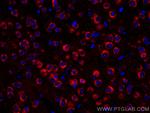 Alpha SNAP Antibody in Immunohistochemistry (Paraffin) (IHC (P))