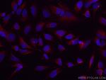 GSK3B Antibody in Immunocytochemistry (ICC/IF)