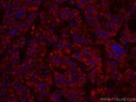 ALDH5A1 Antibody in Immunohistochemistry (Paraffin) (IHC (P))