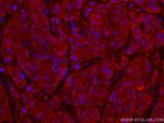 ANAPC5 Antibody in Immunohistochemistry (Paraffin) (IHC (P))