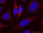 PNPLA3 Antibody in Immunocytochemistry (ICC/IF)