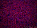 LACTB2 Antibody in Immunohistochemistry (Paraffin) (IHC (P))