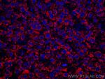 LACTB2 Antibody in Immunohistochemistry (Paraffin) (IHC (P))