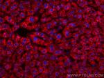 BDH1 Antibody in Immunohistochemistry (Paraffin) (IHC (P))