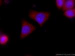 AHCYL2 Antibody in Immunocytochemistry (ICC/IF)
