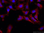 BSEP Antibody in Immunocytochemistry (ICC/IF)