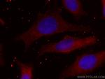CMPK1 Antibody in Immunocytochemistry (ICC/IF)