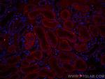 SLC2A9 Antibody in Immunohistochemistry (Paraffin) (IHC (P))