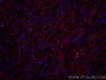 SLC2A9 Antibody in Immunohistochemistry (Paraffin) (IHC (P))