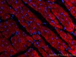 MYL4 Antibody in Immunohistochemistry (Paraffin) (IHC (P))