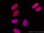 RALYL Antibody in Immunocytochemistry (ICC/IF)