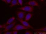 GRP75 Antibody in Immunocytochemistry (ICC/IF)