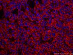SDHB Antibody in Immunohistochemistry (Paraffin) (IHC (P))