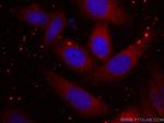 Ch-TOG Antibody in Immunocytochemistry (ICC/IF)